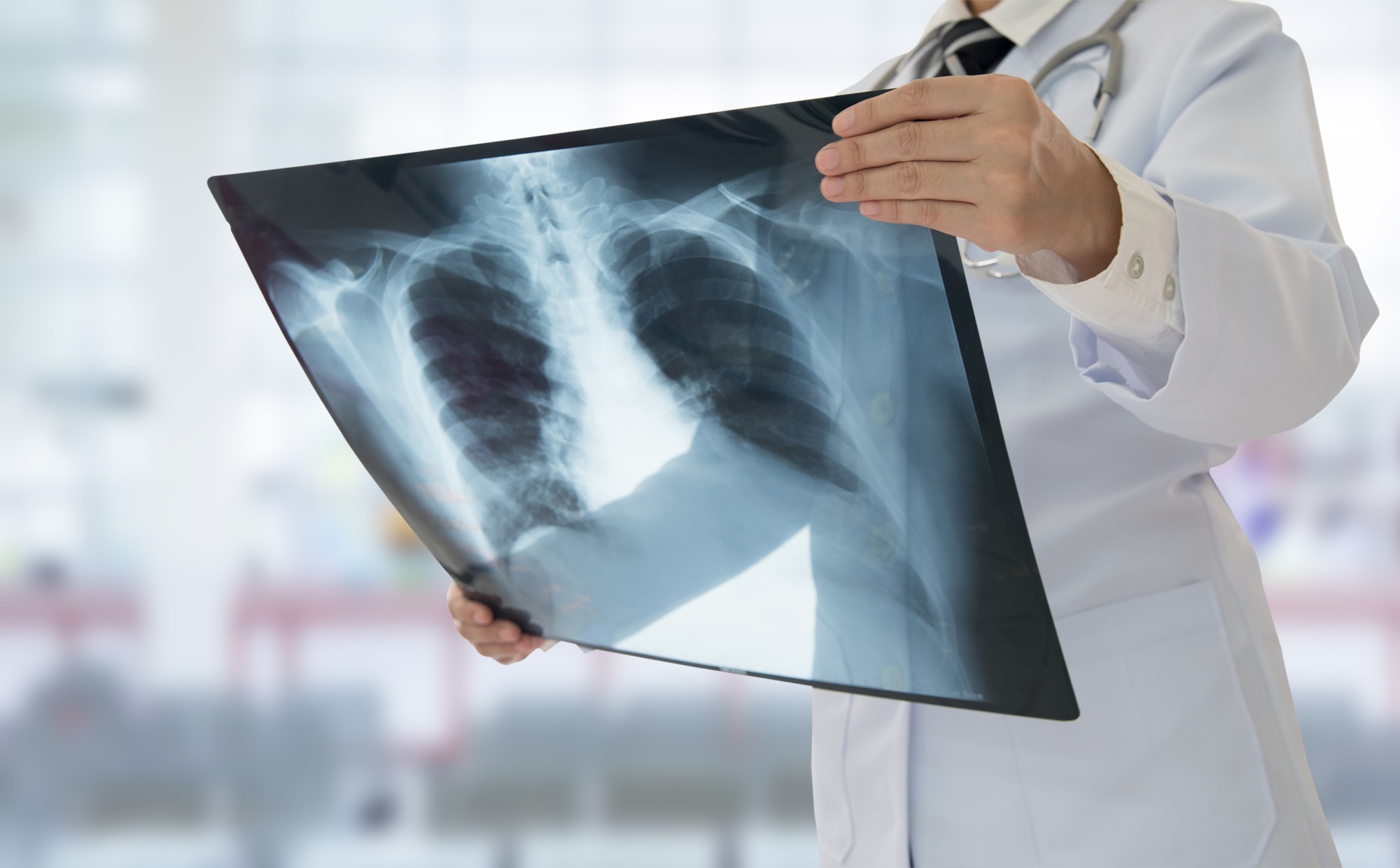 Флюорография органов грудной клетки для первичной диагностики заболеваний органов дыхания в медицинском центре Эндос на Щукинской