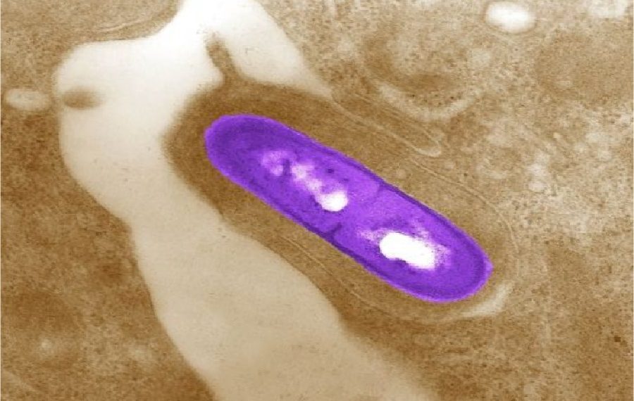 Изображение микроскопии бактерии для вводной статьи к разделу медицинской энциклопедии resursor.ru