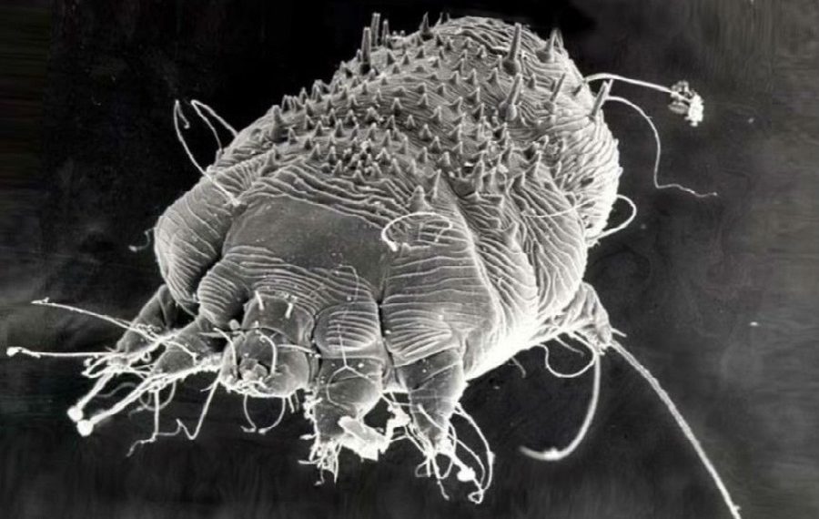 Изображение самки чесоточного клеща, Sarcoptes scabiei, к статье по этиологии, патогенезу и заболеваемости чесоткой, медицинская энциклопедия Resursor