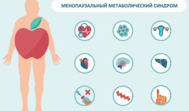 Метаболический синдром менопаузальный, патогенез, риски