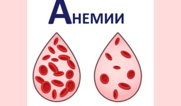 Анемия: определение, базовая классификация