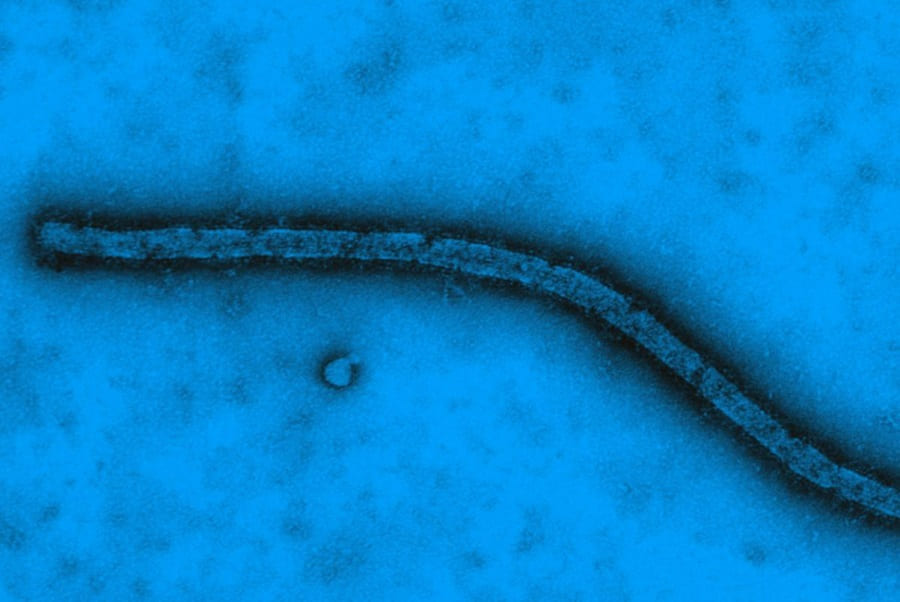 Фрагмент вируса Эбола, Институт Пастера, Франция; Медицинская энциклопедия Ресурсор